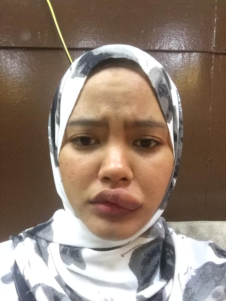Ubat Rasa Nak Muntah  Dralle Damen